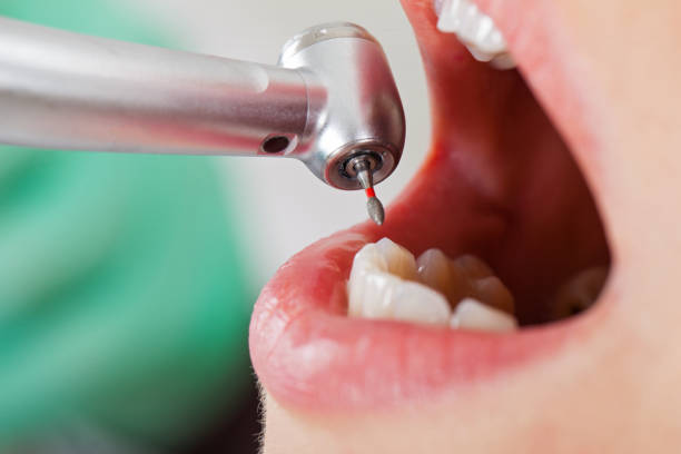 Best Emergency Dentist for Knocked-Out Tooth in Lyford, TX